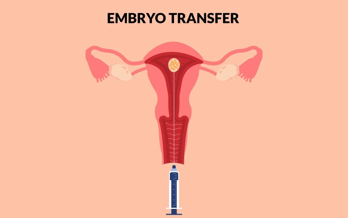 Embryo Donation