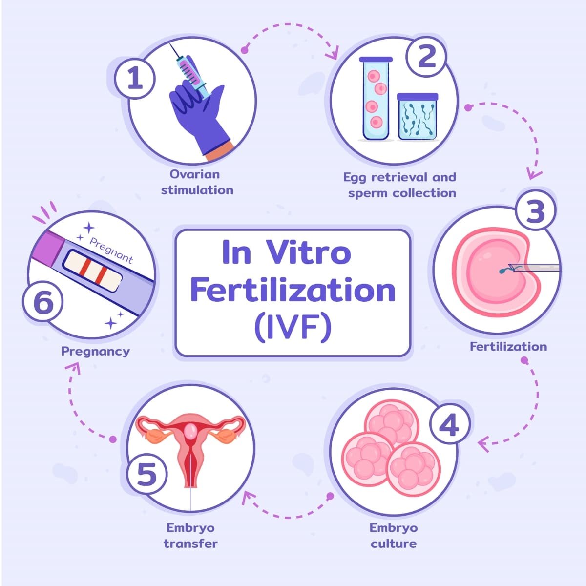 IVF - In Vitro Fertilization